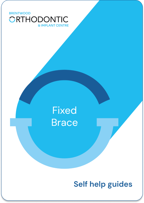 Guide_Fixed Braces