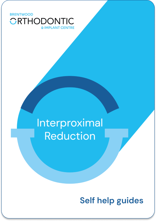 Guide_Interproximal Reduction
