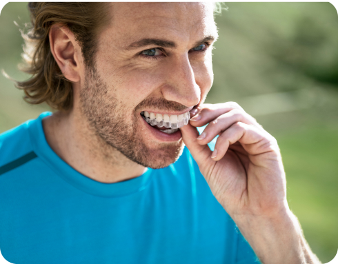 Invisalign for Adults 2